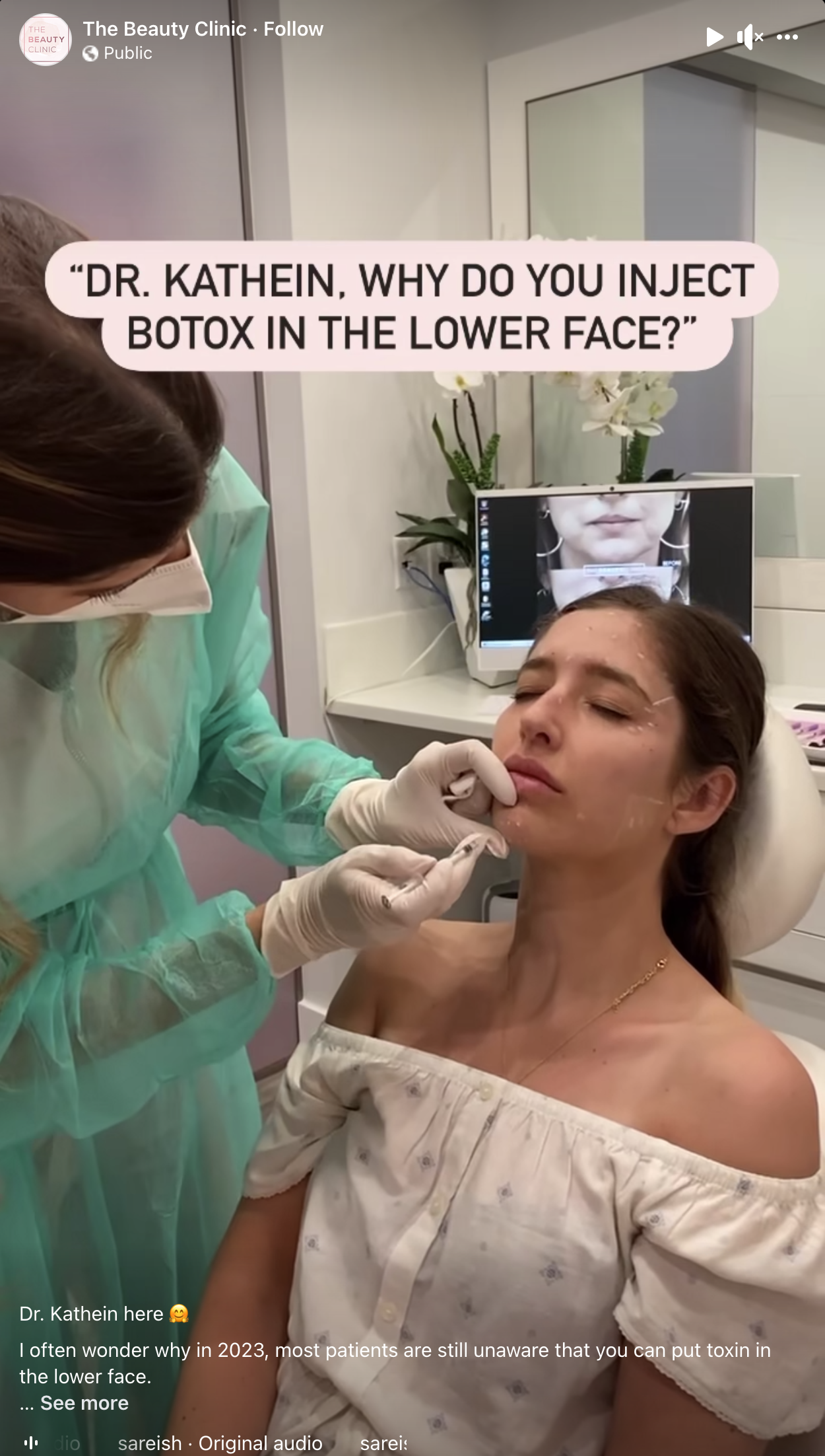 I often wonder why in 2023, most patients are still unaware that you can put toxin in the lower face.
